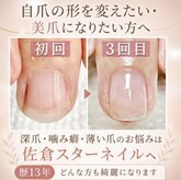 スターネイル(Starnail)