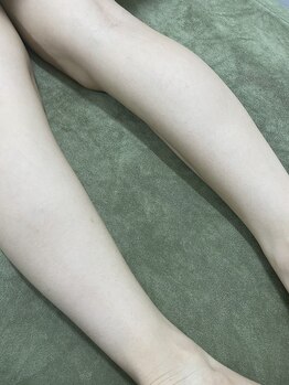 ナノハナ/鹿沼市の全身脱毛のナノハナ