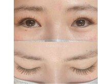 フランキンセンス 香取佐原店/フラットフィットオールカラー