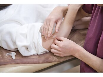 令和さくら鍼灸院 整体院/肘への鍼