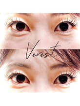 ヴェレスト 西荻窪(Verest)/フラットラッシュ100本3980円