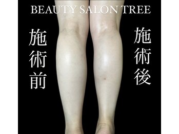 ビューティサロンツリー(TREE)/ラインが整うリンパ90分9500円