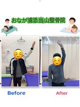 おなが浦添当山整体院/肩可動域改善！