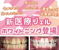 シュシュ(chouchou)