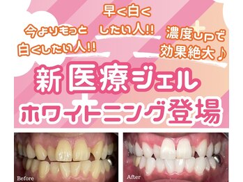 シュシュ(chouchou)