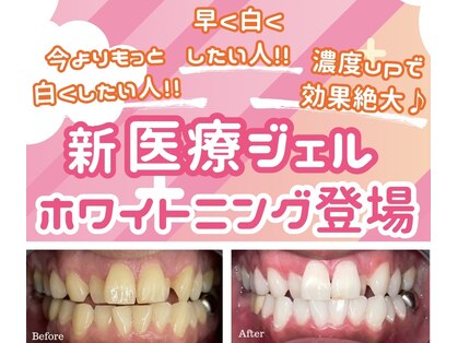 シュシュ(chouchou)の写真