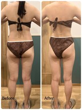 まろんのエステ/40代　痩身エステ（下半身）