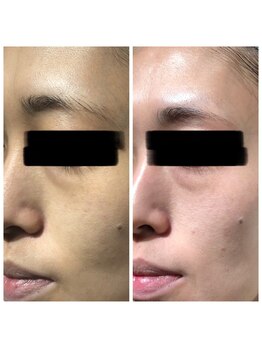 すっぴん美肌革命/くすみが抜けてパッと明るい印象