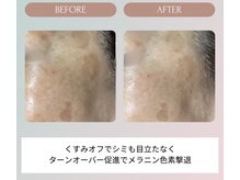 ノーブル(NOBLE)/ムートンホイップスパ大阪/野田