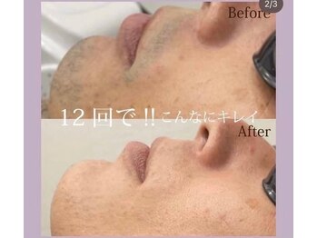 フォルチェ 神辺店(Folche)/結果出てます！体験4400円