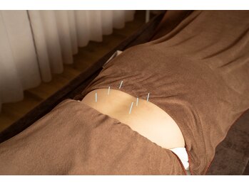 サニー(Sunny)/痛みのケアもお任せください!