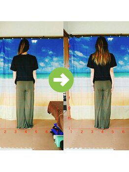 サプライズ整体院/30代ママさんの産後の骨盤初回