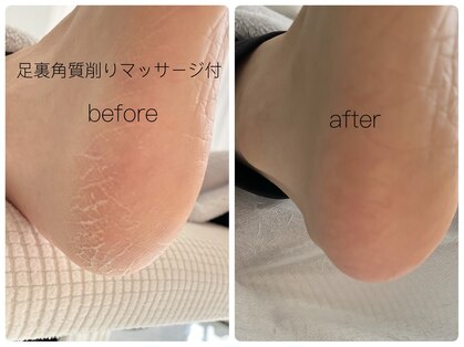 リチャーム(Recharm)の写真