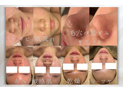 リルビー(Lilby)の写真