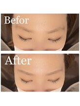 ノーティス 浦和(NOTICE)/WAX脱毛効果