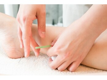 きよらか鍼灸接骨院/心と身体をいやす二人三脚の鍼灸