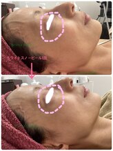 プリマプリート 各務原店/ホワイトスノーピール