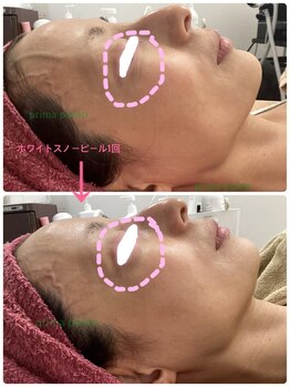 プリマプリート 各務原店/ホワイトスノーピール