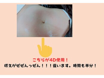 フレクシー/4D使用