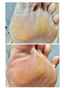 ラヴィ(La vie)/急な乾燥で引っかかる