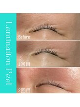 ハナイロ(hana-iro)/ラミネーションピール