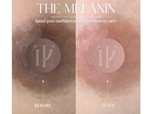 ビューティーホームサロン(Beauty Home Salon)の雰囲気(ついに予約開始!韓国で唯一承認を得ているピンクチェンジ)