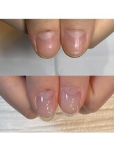 キュア(Cure.)/コンプレックスある爪の悩み解消