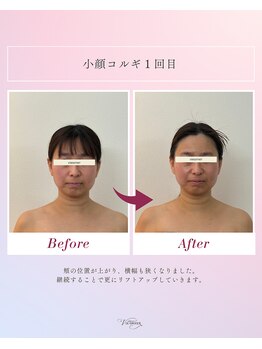 ヴィオルネ(VIE ORNER)/