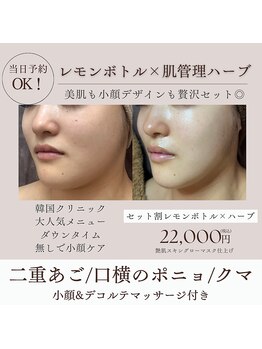 アミーカリーナ 阪急塚口店(Amicarina)の写真/【韓国小顔管理】二重あご・口横のポニョをデザイン小顔で憧れのVフェイスラインへ◎