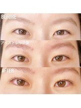 イチマルゴ ガーデン(105 GARDEN)/ダブルアイリフト(staff:RINA)