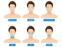 ボス 名古屋 天白店(BOSS)/ 【顔脱毛/ヒゲ脱毛】ヒゲ全体