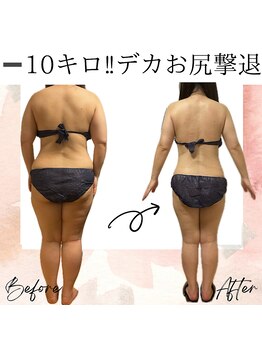 サロン ド ボーテ ラーンジュ 岐阜店(salon de beaut'e L'ange)/ハイパ-ナイフEX2ダイエット痩身