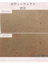 パルティノ 高崎店/ワックス脱毛