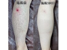 ファブ 川越店/【お客様ビフォーアフター】