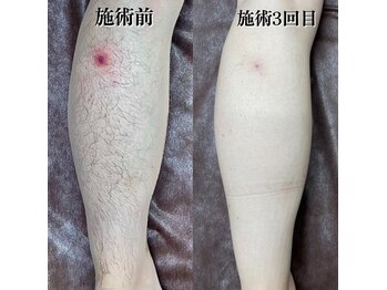 ファブ 川越店/【お客様ビフォーアフター】