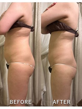 サロンハート(Salon Heart)/