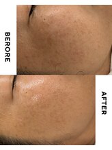 フィックスユー ビューティー(Fixyou BEAUTY)/