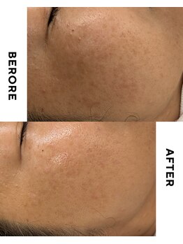 フィックスユー ビューティー(Fixyou BEAUTY)/