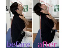 骨盤背骨矯正で圧倒的効果実感！