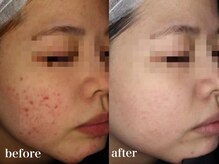 リアルナ(REALUNA)/