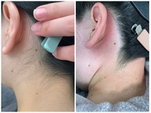 ウル(ulu)/前日当日の施術は控えてください