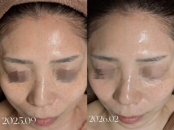 ウィハナ(wehana)/【セラピール】透明感/艶感