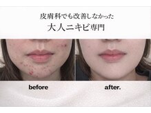 プリベンティブ ビューティー ティップス(Preventive Beauty Tips)