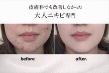 プリベンティブ ビューティー ティップス(Preventive Beauty Tips)