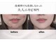 プリベンティブ ビューティー ティップス(Preventive Beauty Tips)の写真