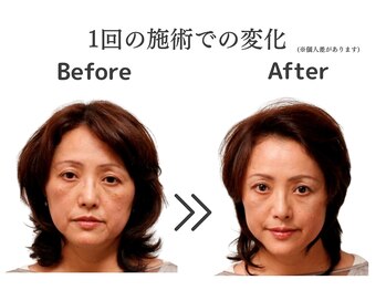 ケー(K)/ビフォーアフター