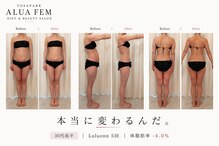 ヨサパーク アルア フェム(YOSA PARK ALUA FEM)