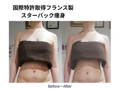 RiとBiのたまごの写真