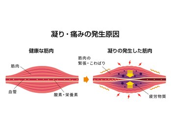 リラクゼーションスパ ソラシエ/