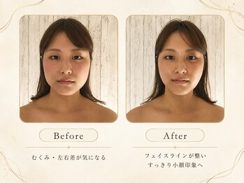オーバイワン 自由が丘本店(Oby1)/小顔矯正[エラ/フェイスライン]